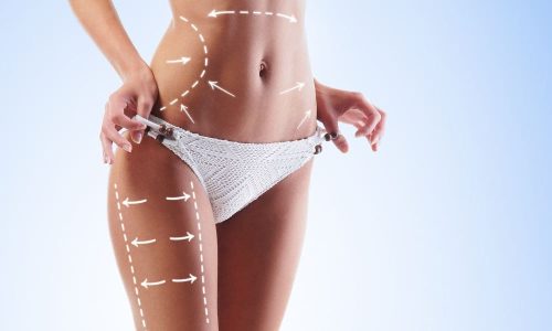 Lose Inches With Liposculpture Blog Feature Image - Ashbury Cosmetics on Brisbane & the Gold Coast