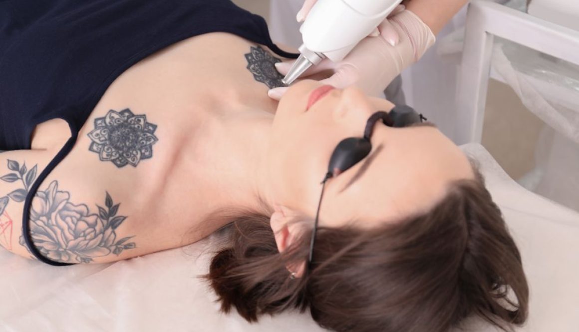 Tattoo Removal Big With People Under 30 Blog Feature Image - Ashbury Cosmetics on Brisbane & the Gold Coast