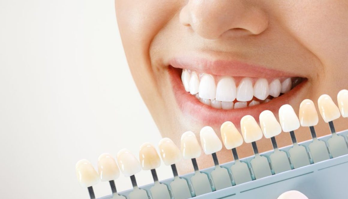 Achieve A Whiter, Brighter Smile In Only One Hour! Blog Feature Image - Ashbury Cosmetics on Brisbane & the Gold Coast