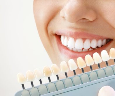 Achieve A Whiter, Brighter Smile In Only One Hour! Blog Feature Image - Ashbury Cosmetics on Brisbane & the Gold Coast
