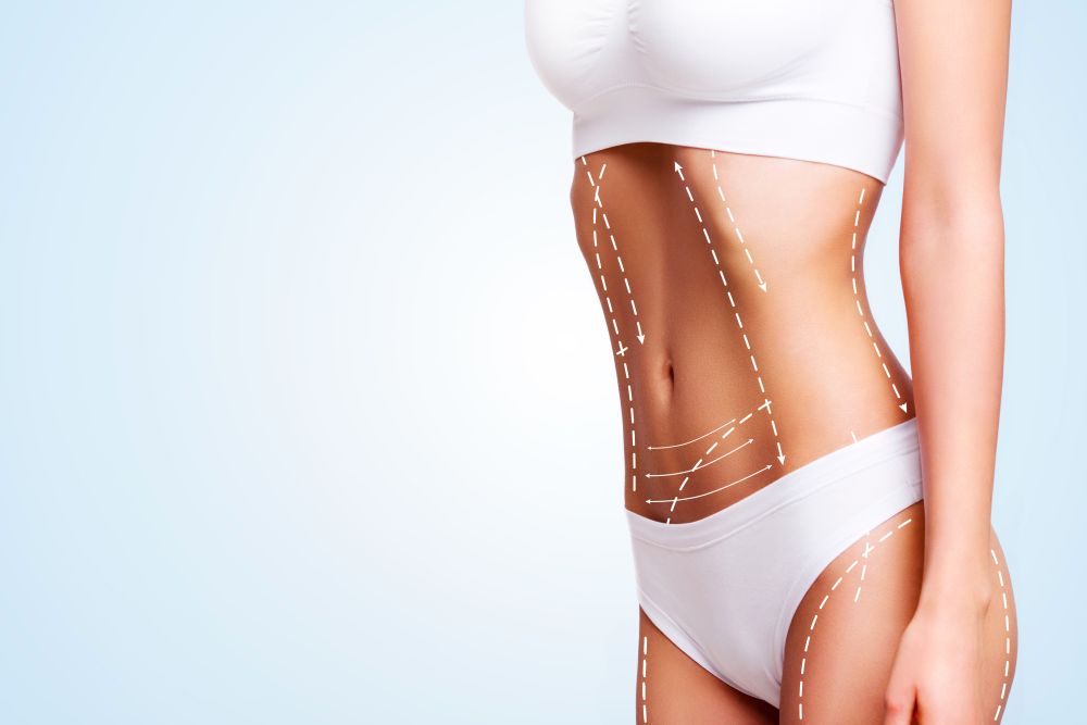 4 Celebrities Who Have Had Liposuction Blog Feature Image - Ashbury Cosmetics on Brisbane & the Gold Coast